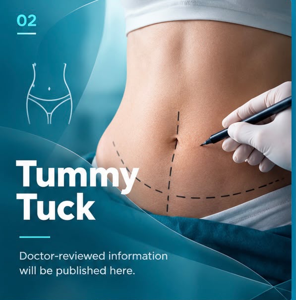 Tummy Tuck